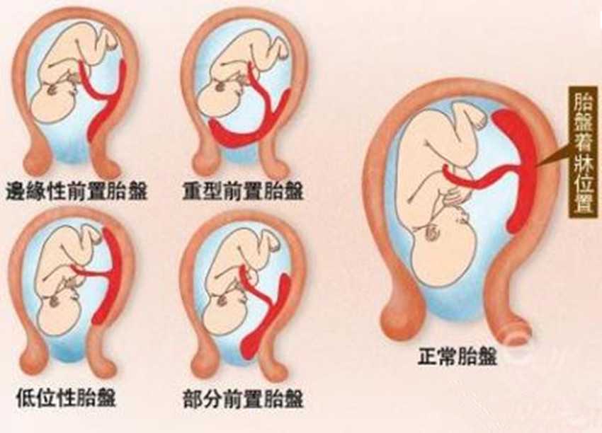孕宝哪里有代孕的呀,南京试管医院排名前十名